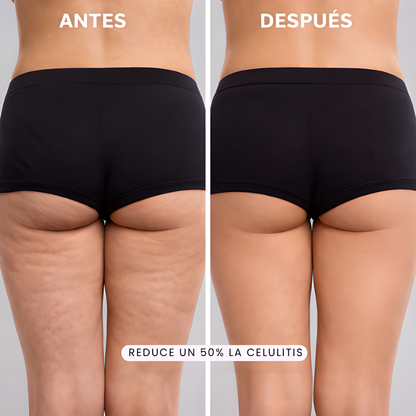 Masajeador anticelulítico 5 en 1